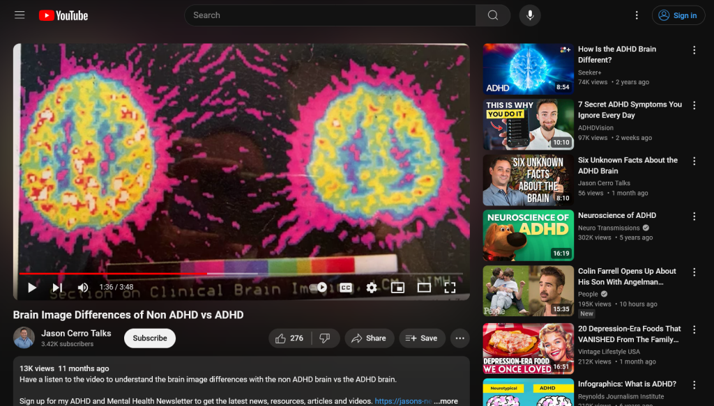 Screenshot 2024-08-07 at 17-38-23 Brain Image Differences of Non ADHD vs ADHD - YouTube.png